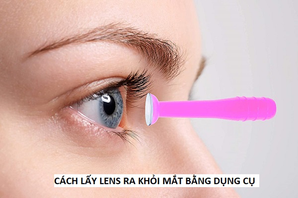 Cách Lấy Lens Ra Khỏi Mắt Bằng Dụng Cụ Đơn Giản Và An Toàn Nhất