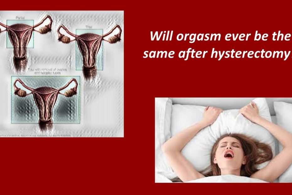 Will Orgasm Ever Be The Same After Hysterectomy For Uterine Prolapse? —  Apops